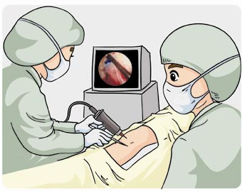 人體植入醫療器械封口潔凈要求 人體植入醫療器械封口潔凈要求